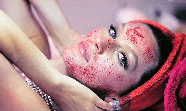 vampire facial vedic sutra