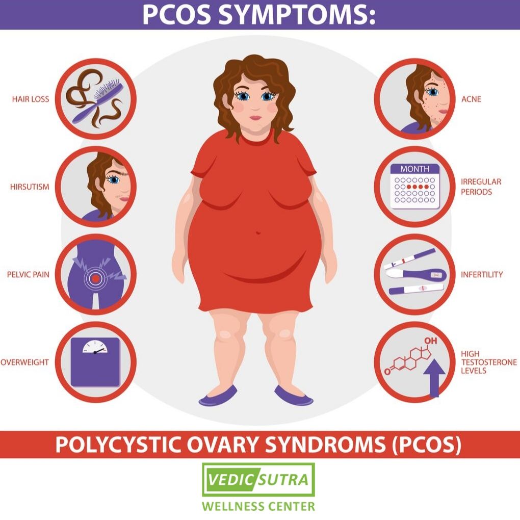 pcos symptoms 1