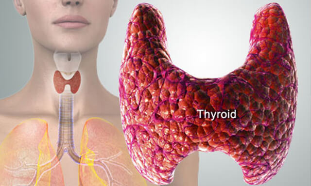 Thyroid Treatment Ayurvedic