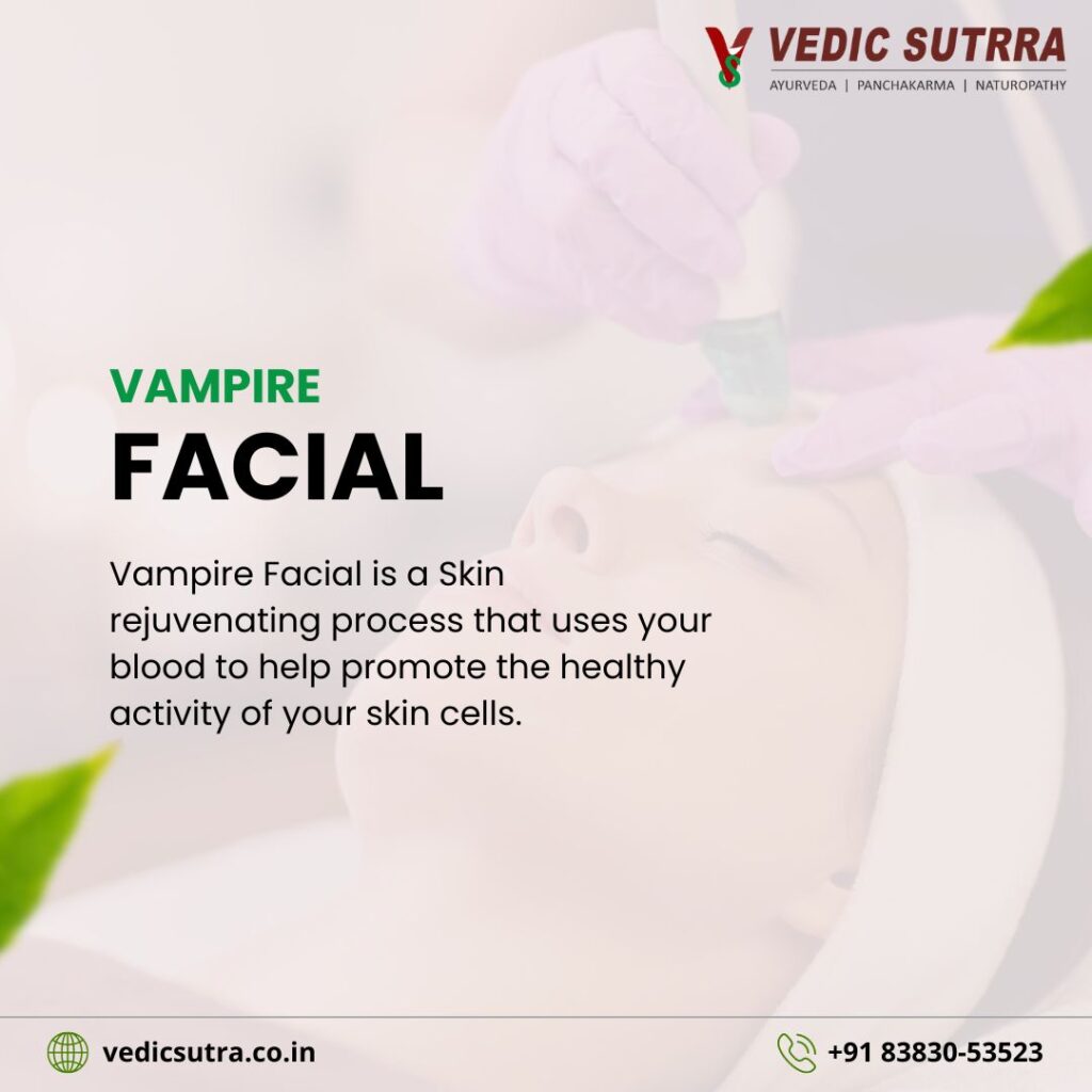 Vampire Facial