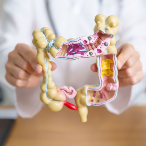 Ulcerative Colitis 1