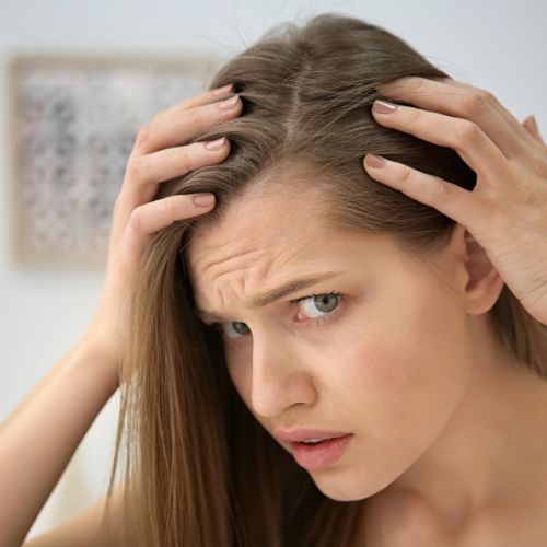 Thinning of Scalp Hair