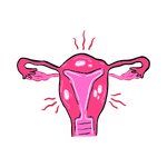 PCOS & Hormonal Issues